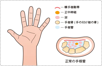 正常の手根管