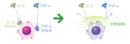 メトトレキサートや生物製剤による治療