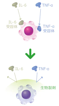 メトトレキサートや生物製剤による治療